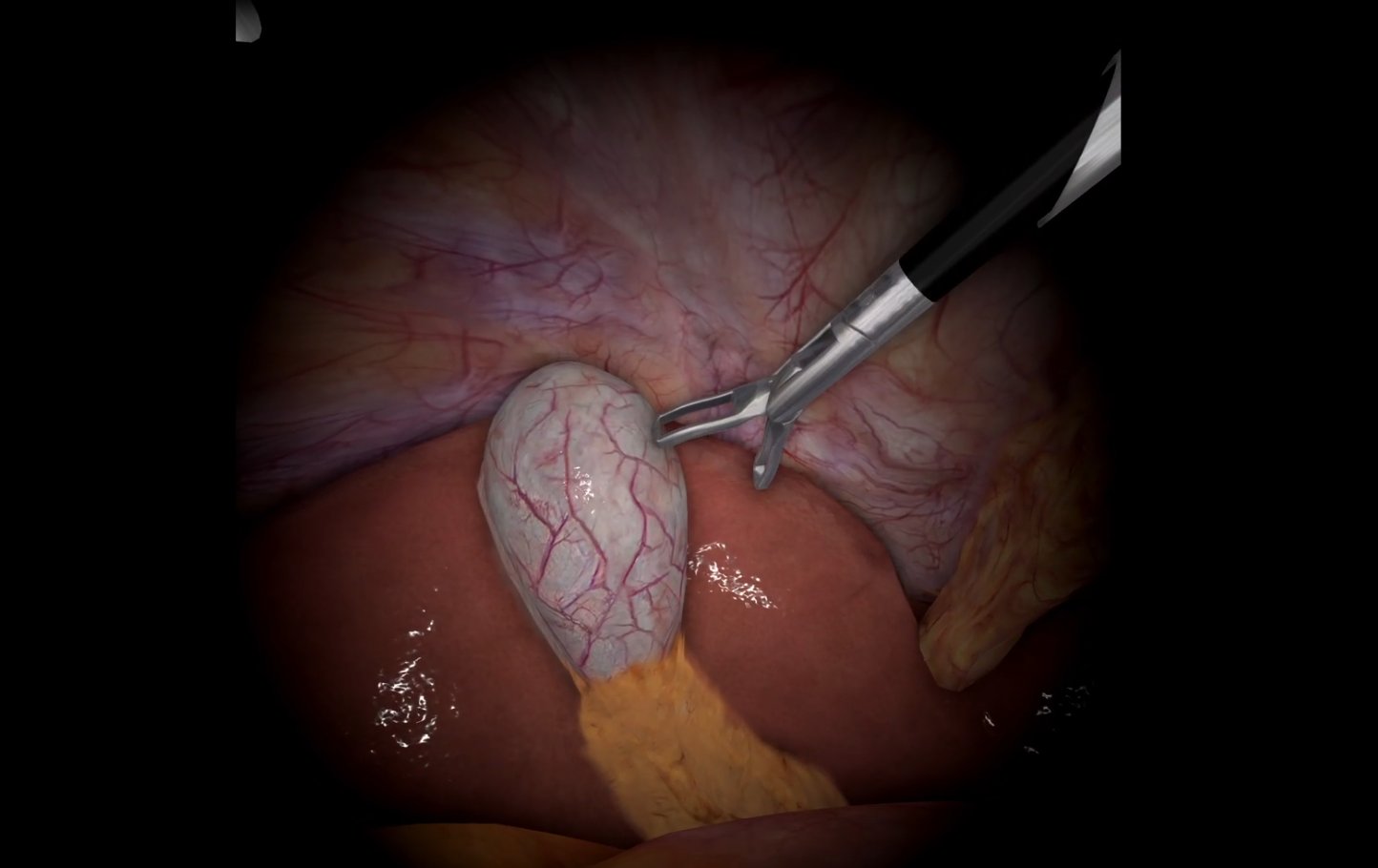 Heal Simulations surgical haptics and instrument interaction simulation view
