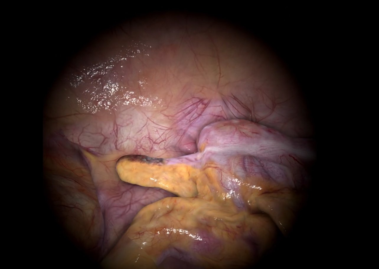 Heal Simulations soft-body tissue physics simulation view